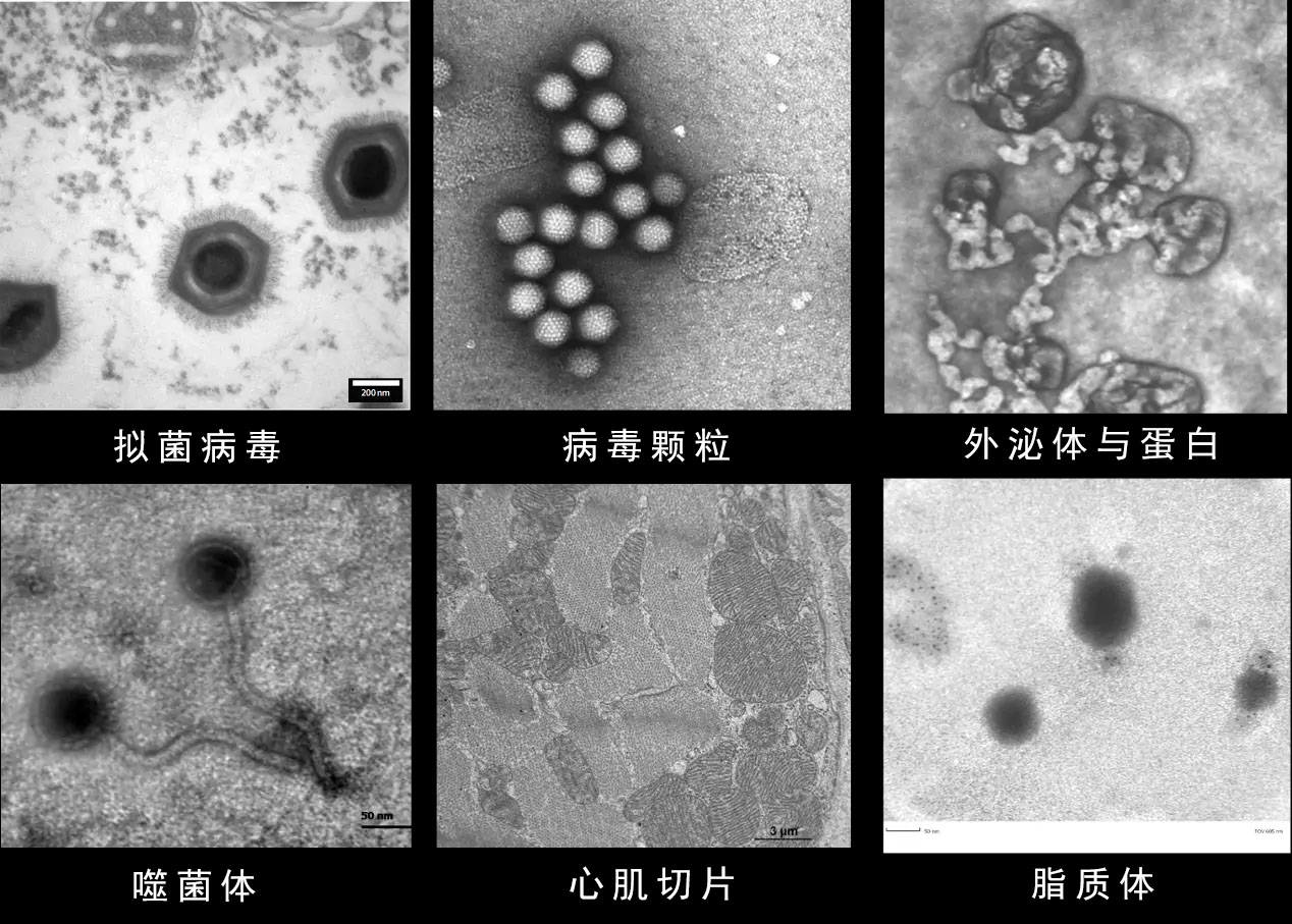 透射电镜负染色技术